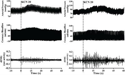 Regulation of Coronary Blood Flow by the Carotid Body Chemoreceptors in Ovine Heart Failure